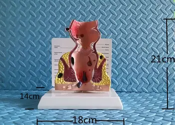 Patoloģiskais taisnās zarnas modeli crissum Anorectal anatomija modelis